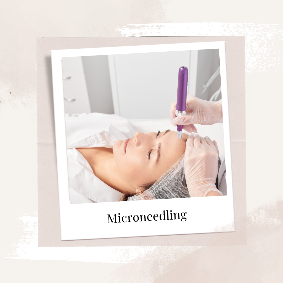 Microneedling